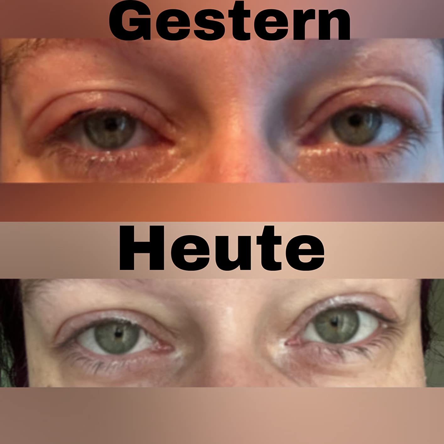 Zu fest