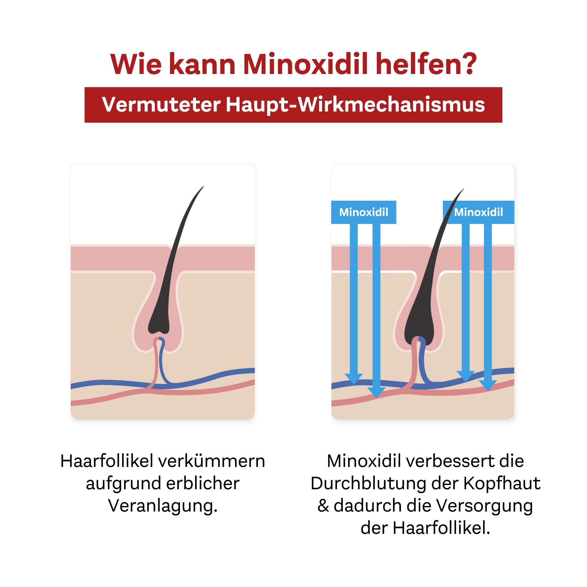 doppelherzpharma-minoxidil-50-mg-ml-5-l-sung-zur-anwendung-auf-der-haut-3x-60-ml image 7