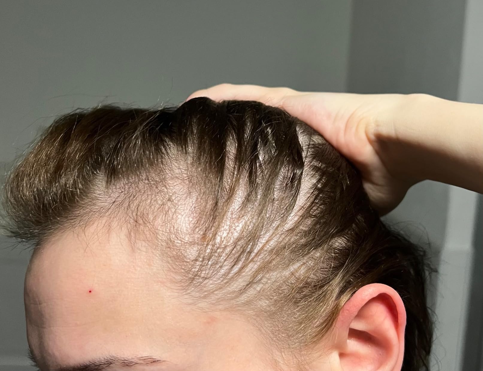 Endlich wieder Haare!