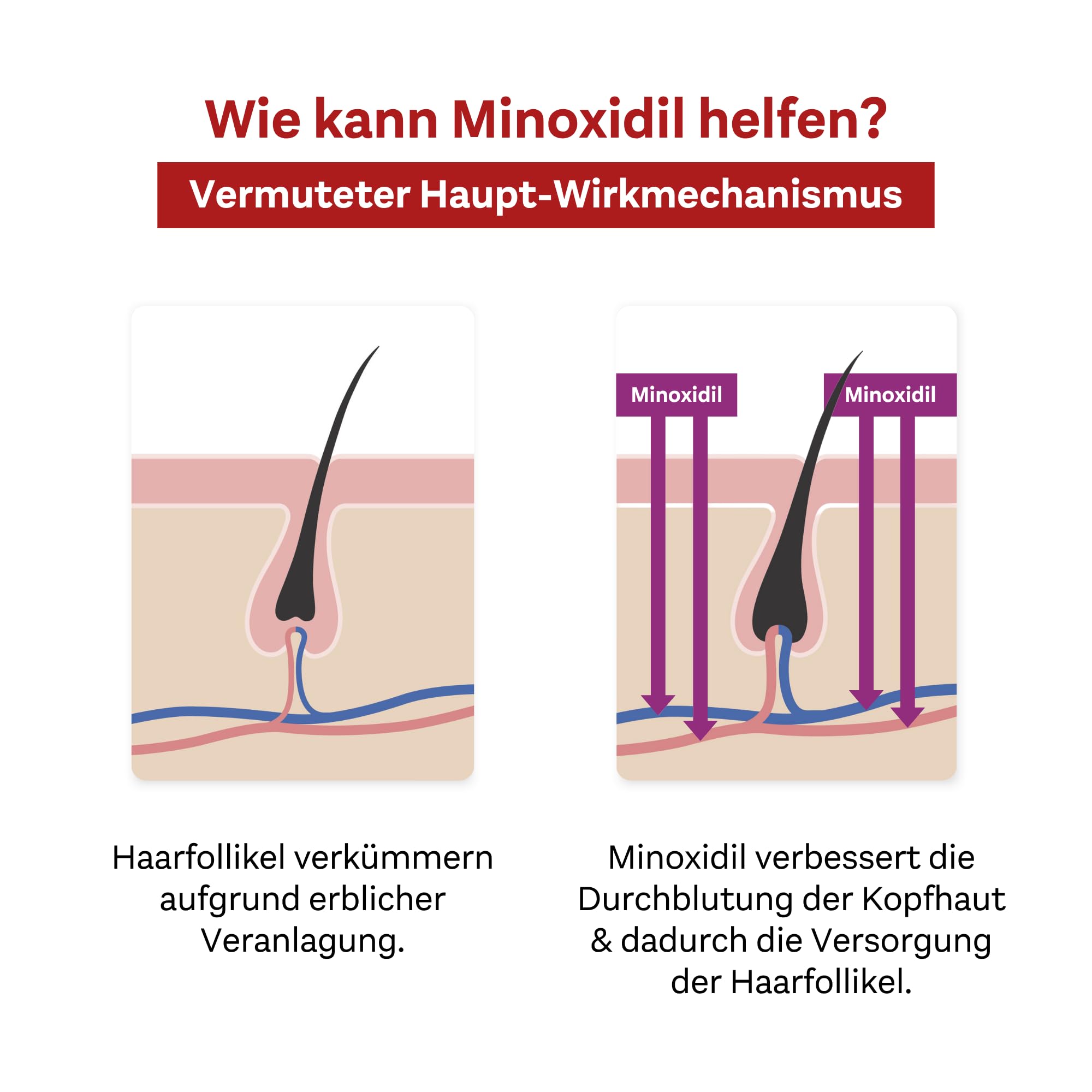 doppelherzpharma-minoxidil-20-mg-ml-2-l-sung-3x-60-ml-f-r-frauen image 7